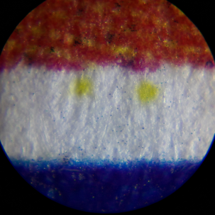 Gelbe Punkte unter dem Mikroskop